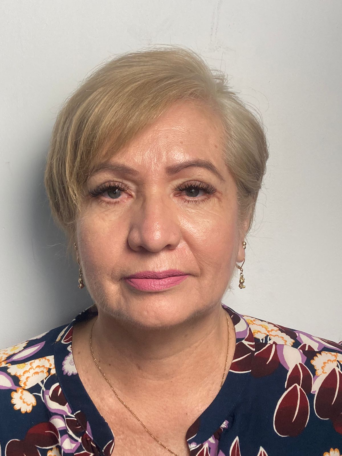 Antes blefaroplastia